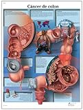 3B Scientific Lehrtaffel laminiert